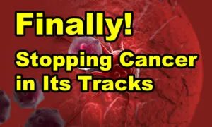 Cancer Trial